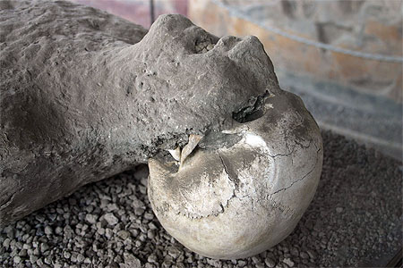 Moulage de corps Moulage de corps